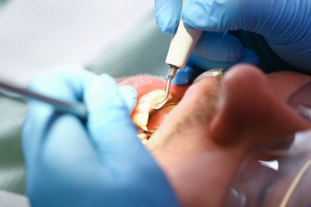Best Broken or Cracked Tooth Emergency Dentist in West Swanzey, NH