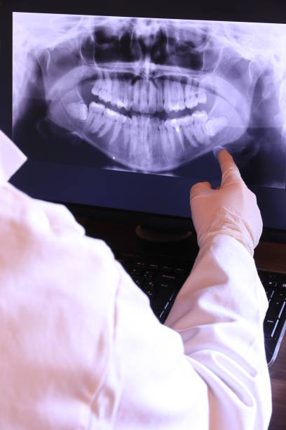 Best Emergency Root Canal Treatment in West Swanzey, NH